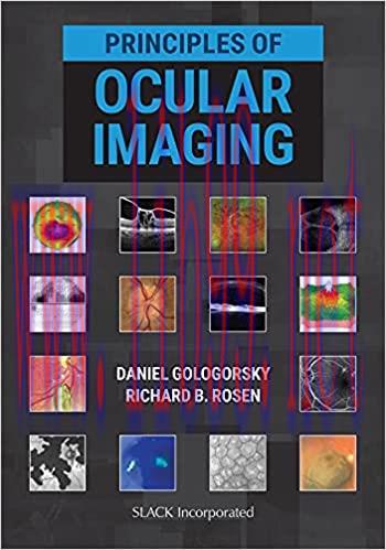 [PDF]Principles of Ocular Imaging [Daniel Gologorsky]