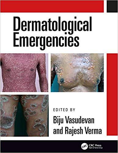 Dermatological Emergencies [Biju Vasudevan]