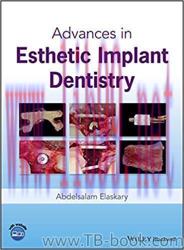 Advances in Esthetic Implant Dentistry 1st Edition by Abdelsalam Elaskary