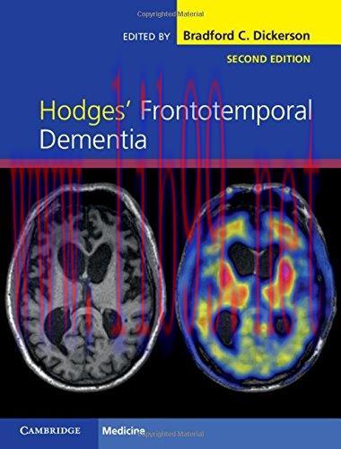 [AME]Hodges&rsquo; Frontotemporal Dementia, 2nd Edition