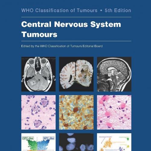 Central Nervous System Tumours: WHO Classification of Tumours 5th Edition