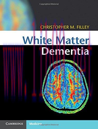 [AME]White Matter Dementia