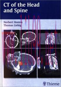 [AME]CT of the Head and Spine