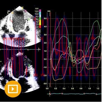 [AME]Echocardiography &ndash; A Comprehensive Review 2022 (CME VIDEOS)