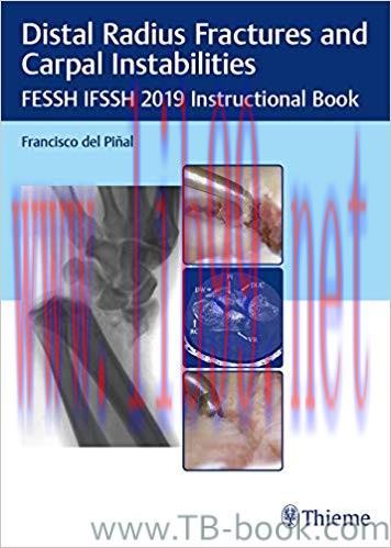 Distal Radius Fractures and Carpal Instabilities: FESSH IFSSH 2019 Instructional Book 1st Editi...