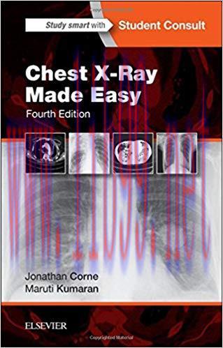 [PDF]Chest X-ray Made Easy,Fourth Edition