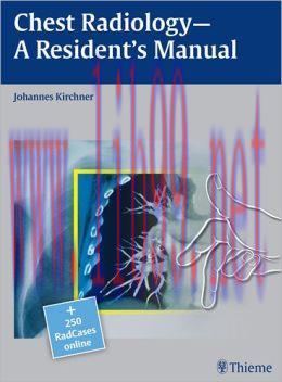[AME]Chest Radiology- A Resident's Manual (ORIGINAL PDF from_ Publisher)