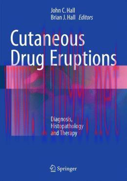 [AME]Cutaneous Drug Eruptions: Diagnosis, Histopathology and Therapy (PDF)