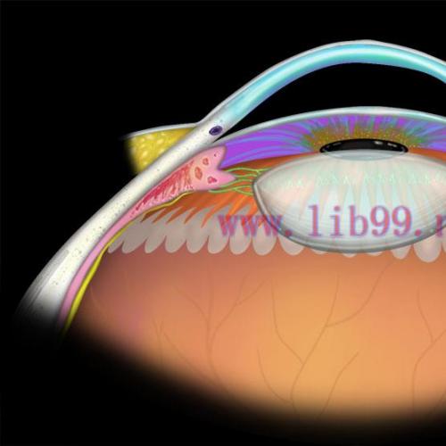 [AME]MRIOnline Imaging Mastery Series Orbit 2019 (CME VIDEOS)