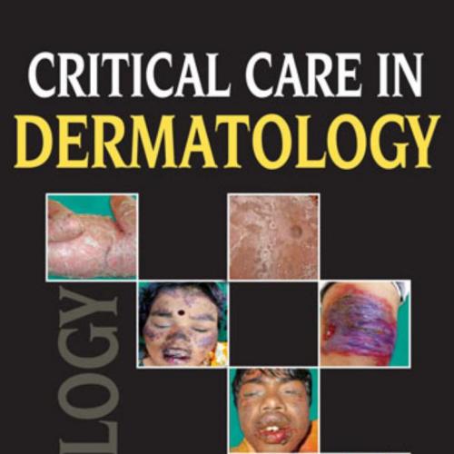 Critical Care in Dermatology