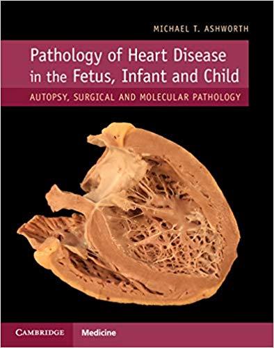 Pathology of Heart Disease in the Fetus, Infant and Child