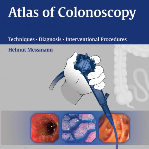 Atlas of Colonoscopy _ Techniques, Diagnosis, Interventional Procedures - Wei Zhi