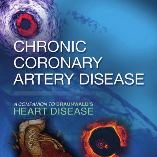 [AME]Chronic Coronary Artery Disease: A Companion to Braunwald&rsquo;s Heart Disease E-Book 1st Editi...