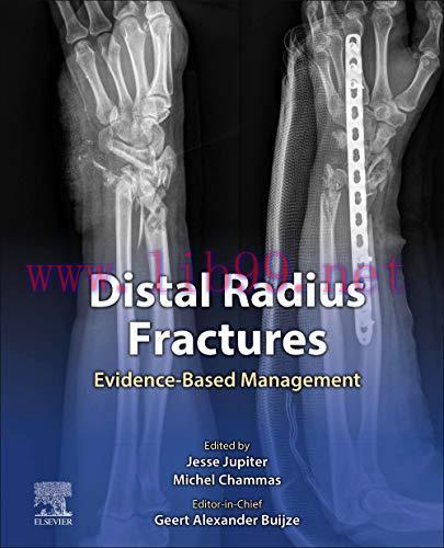 [AME]Distal Radius Fractures: Evidence-Based Management (True PDF+ToC+Index+Videos)