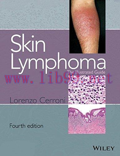 [AME]Skin Lymphoma: The Illustrated Guide, 4th Edition