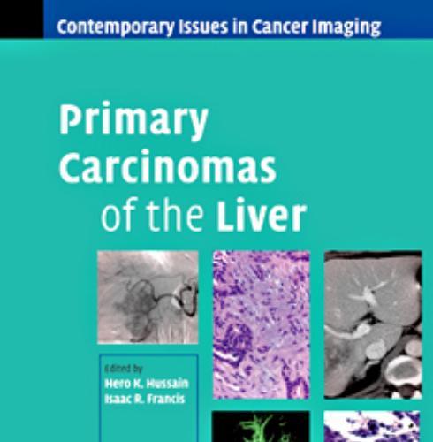 Primary Carcinomas of the Liver