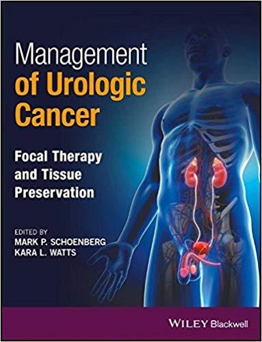 Management of Urologic Cancer