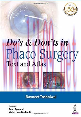 [AME]Do&rsquo;s & Dont&rsquo;s in Phaco Surgery: Text and Atlas (Original PDF)