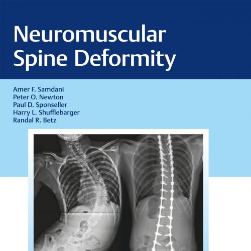 Thieme_ Neuromuscular Spine Deformity-Samdani, Amer F.; Peter O. Newton; Paul D. Sponseller; a....