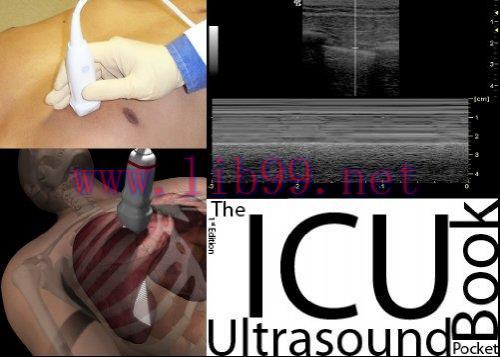 [AME]The ICU Ultrasound Pocket Book (Original PDF)