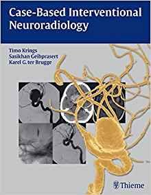 Case-based Interventional Neuroradiology