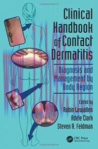 [AME]Clinical Handbook of Contact Dermatitis: Diagnosis and Management by Body Region