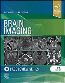 [AME]Brain Imaging: Case Review Series, 3rd edition (Original PDF)