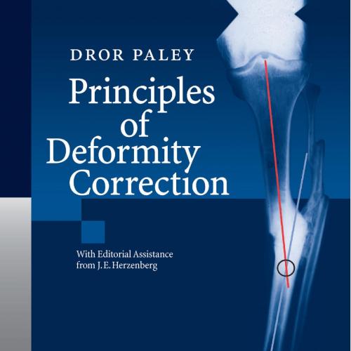 Principles of Deformity Correction