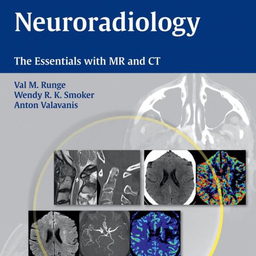 Neuroradiology The Essentials with MR and CT