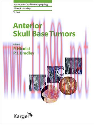 [AME]Anterior Skull Base Tumors (Advances in Oto-Rhino-Laryngology, Vol. 84) (Original PDF)
