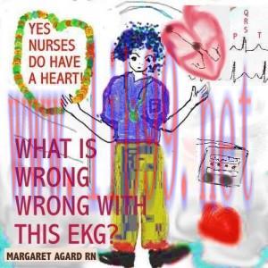 [AME]EKG Series Part 1 What is Wrong with this EKG (EPUB)