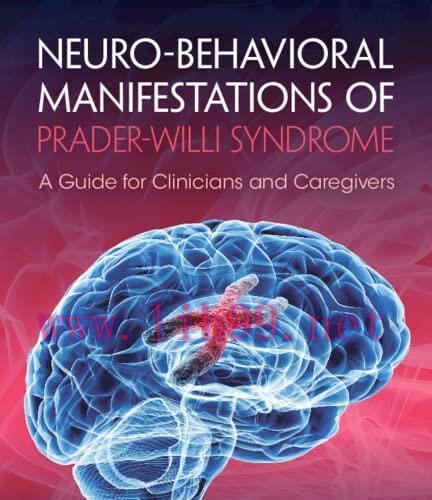 [AME]Neuro-behavioral Manifestations of Prader-Willi Syndrome (Original PDF)