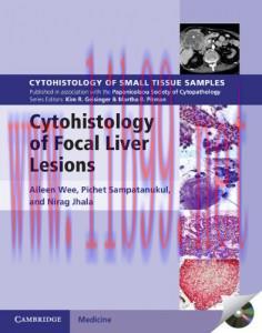 [AME]Cytohistology of Focal Liver Lesions