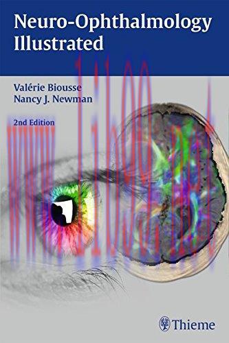 [AME]Neuro-Ophthalmology Illustrated, 2nd Edition (ORIGINAL PDF from_ Publisher)