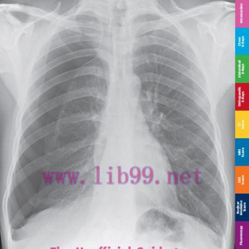 [AME]The Unofficial Guide to Radiology - Chest, Abdominal, Orthopaedic X Rays, plus CTs, MRIs a...