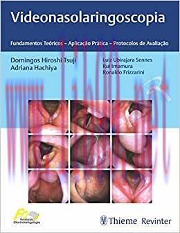 [AME]Videonasolaringoscopia: Fundamentos Te&oacute;ricos &ndash; Aplica&ccedil;&atilde;o Pr&aacute;tica &ndash; Protocolos de Avalia&ccedil;&atilde;o...