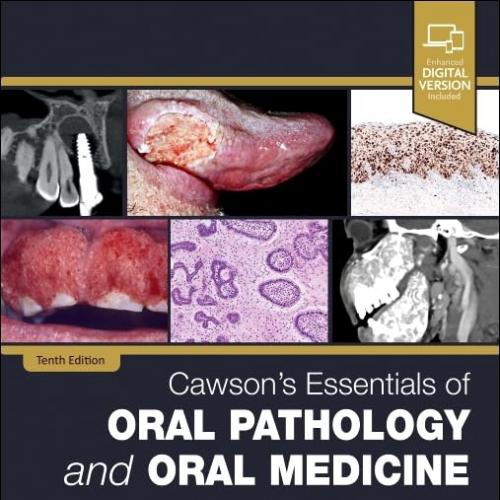 Cawson&rsquo;s Essentials of Oral Pathology and Oral Medicine 10th Edition