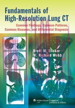 [AME]Fundamentals of High-Resolution Lung CT: Common Findings, Common Patterns, Common Diseases...