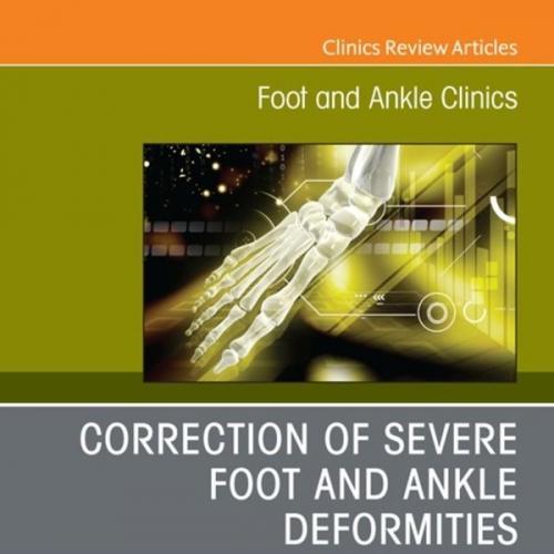 Correction of Severe Foot and Ankle Deformities