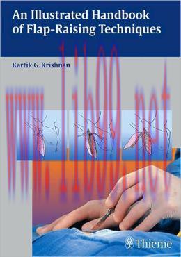 [AME]An Illustrated Handbook of Flap-Raising Techniques