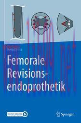 [AME]Femorale Revisionsendoprothetik (Original PDF)