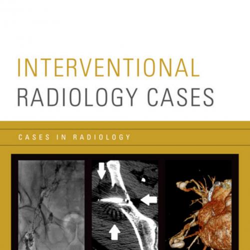 Interventional Radiology Cases