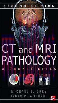 [AME]CT & MRI Pathology: A Pocket Atlas, Second Edition (ORIGINAL PDF from_ Publisher)