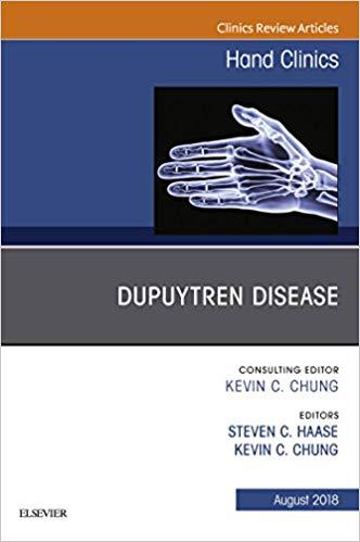 Dupuytren Disease