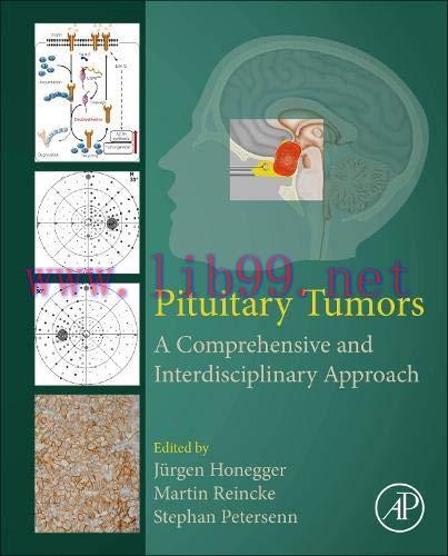[AME]Pituitary Tumors: A Comprehensive and Interdisciplinary Approach (Original PDF)