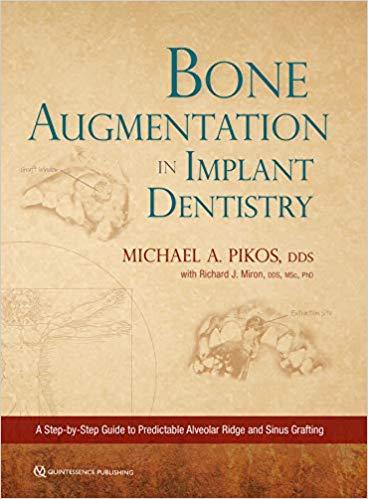 Bone Augmentation in Implant Dentistry A Step-by-Step Guide to Predictable Alveolar Ridge and S...
