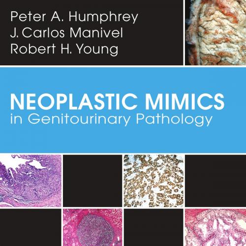 Neoplastic Mimics in Genitourinary Pathology
