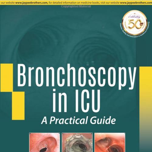 Bronchoscopy in ICU A Practical Guide