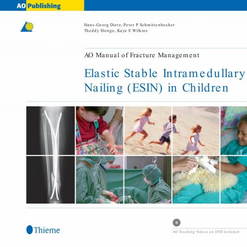 Elastic Stable Intramedullary Nailing (ESIN) in Children - Wei Zhi