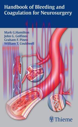 [AME]Handbook of Bleeding and Coagulation for Neurosurgery